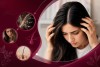 شوره سر و ریزش مو؛ آیا شوره می‌تواند باعث کم‌پشتی و ریزش مو شود؟
